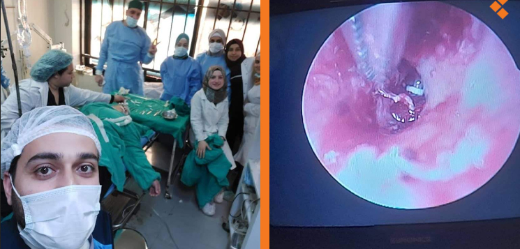 لأول مرة في حماة.. عمل جراحي يعيد السمع لسيدة بنسبة 70%