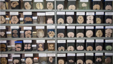 لماذا تحتفظ جامعة دانماركية بنحو 10 آلاف دماغ بشري في الفورمالين؟